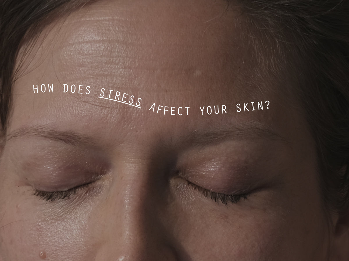 How stress affects your skin and wellbeing